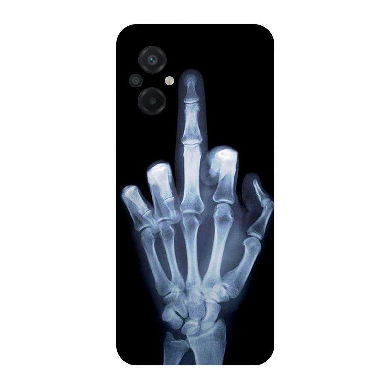 for Poco M5 2022 4G Case Footb - Phone Cases Liverpool 리뷰 및 가격